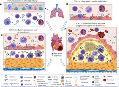 Immune Mechanisms in Cardiovascular Diseases Associated With Viral Infection